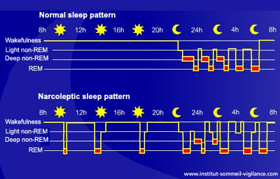 Normal sleep pattern